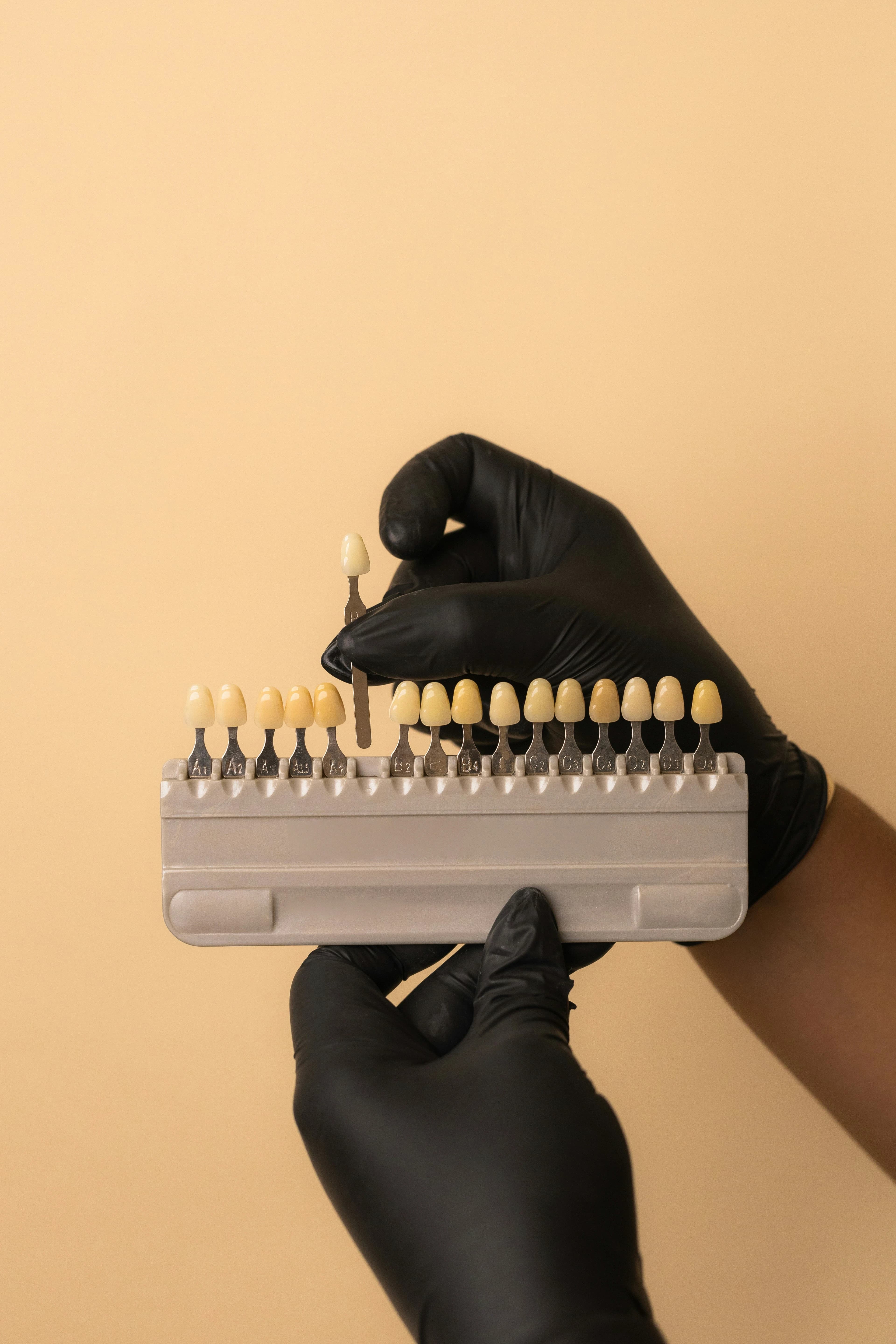 Porcelain veneers being fitted